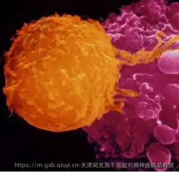 天津间充质干细胞对哪种疾病最有效