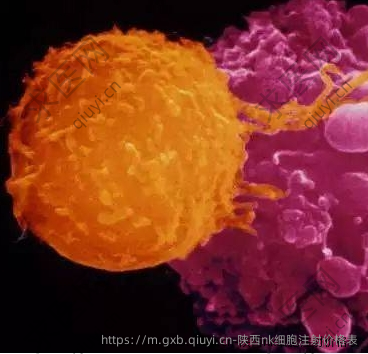 陕西nk细胞注射价格表