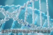 重庆干细胞移植治疗肝硬化案例
