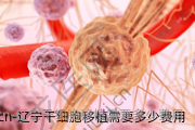 辽宁干细胞移植需要多少费用