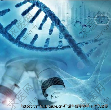 广州干细胞移植手术怎么做