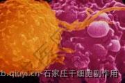 石家庄干细胞副作用
