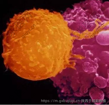 陕西干细胞移植