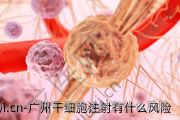 广州干细胞注射有什么风险