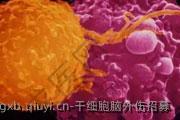 干细胞脑外伤招募