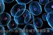 浙江糖尿病干细胞采集