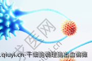 干细胞调理脑出血偏瘫