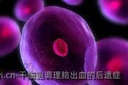 干细胞调理脑出血的后遗症
