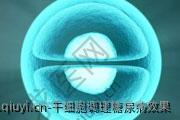 干细胞调理糖尿病效果