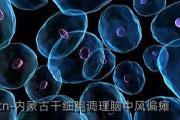 内蒙古干细胞调理脑中风偏瘫