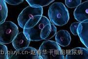 赵春华干细胞糖尿病