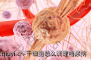 干细胞怎么调理糖尿病